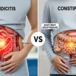 Appendicitis or Constipation